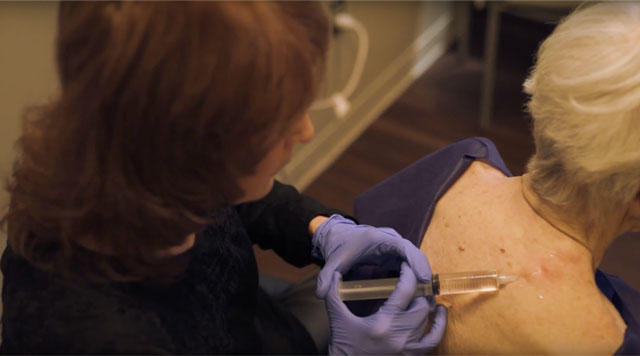 Prolotherapy Helps Heal Painful Musculoskeletal Conditions image